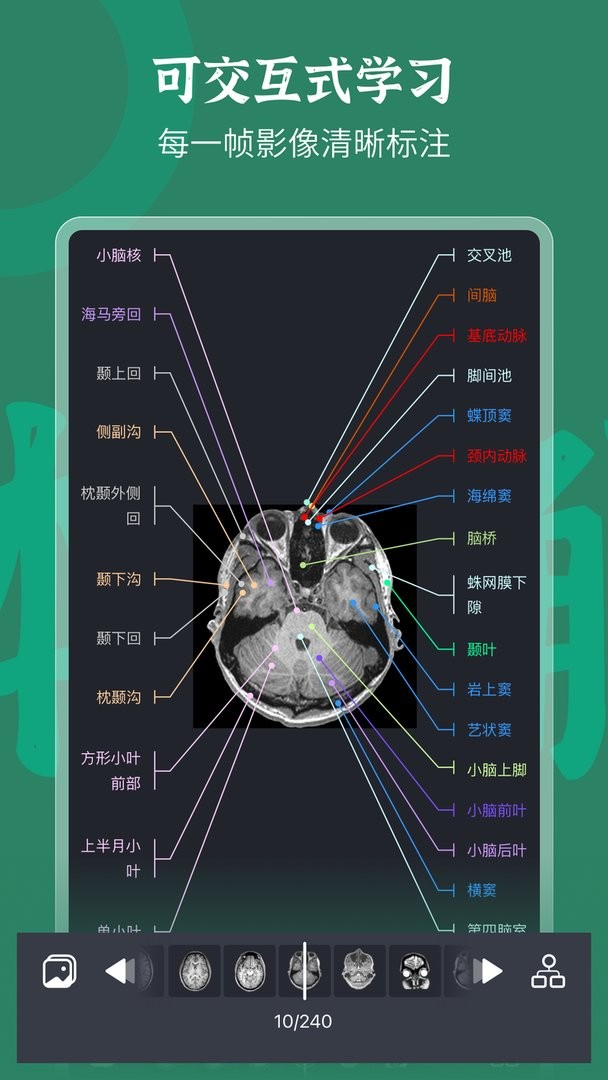 万康人体解剖免费版截图2